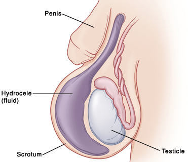 hogyan lehet erekciót emelni népi gyógymódokkal a pénisz erekcióval növekszik